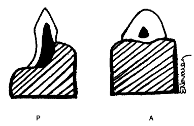 pleurodont and acrodont teeth